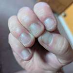 image for Doesn't look much but I've been biting my nails since I can remember, I've got nails! (M34)