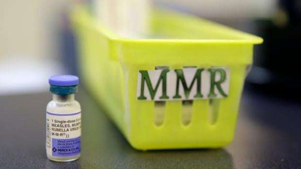 image for Alberta's measles outbreaks surpass case counts reported for entire U.S.
