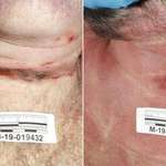 image for Graphic photos show Jeffrey Epstein shortly after his death. Epstein had several broken neck bones.