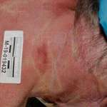 image for Another Graphic Epstein autopsy photo.