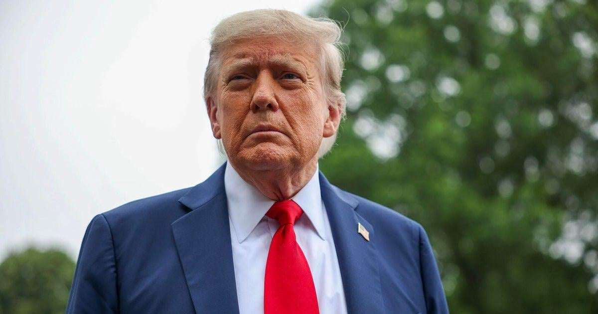 image for Trump diagnosed with chronic venous insufficiency, a minor vein condition, after noticing swelling in legs