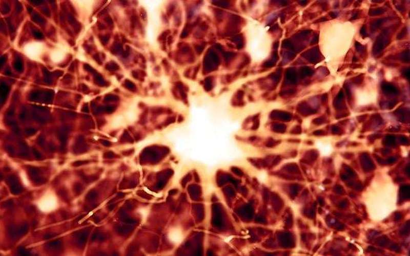image for Scientists Find 2 Existing Drugs Can Reverse Alzheimer's Brain Damage in Mice