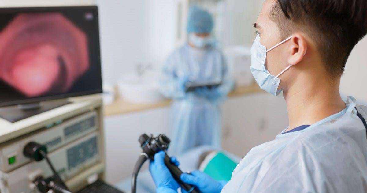 image for More early stage colon cancers found in people aged 45-49 due to more screenings, research shows