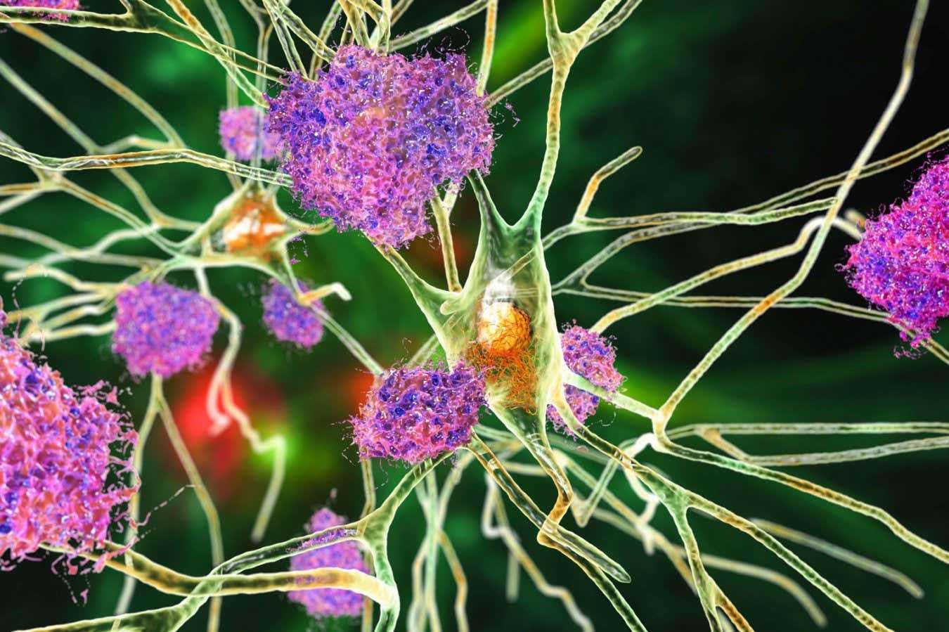 image for Low dose of lithium reverses Alzheimer's symptoms in mice