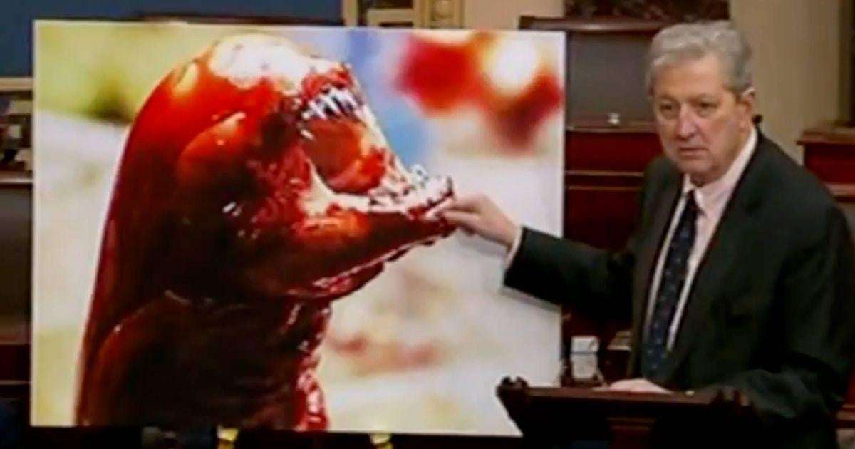 image for Sen. John Kennedy says radioactive shrimp will turn you into an Alien