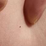 image for The tiniest tick I've ever found on myself.