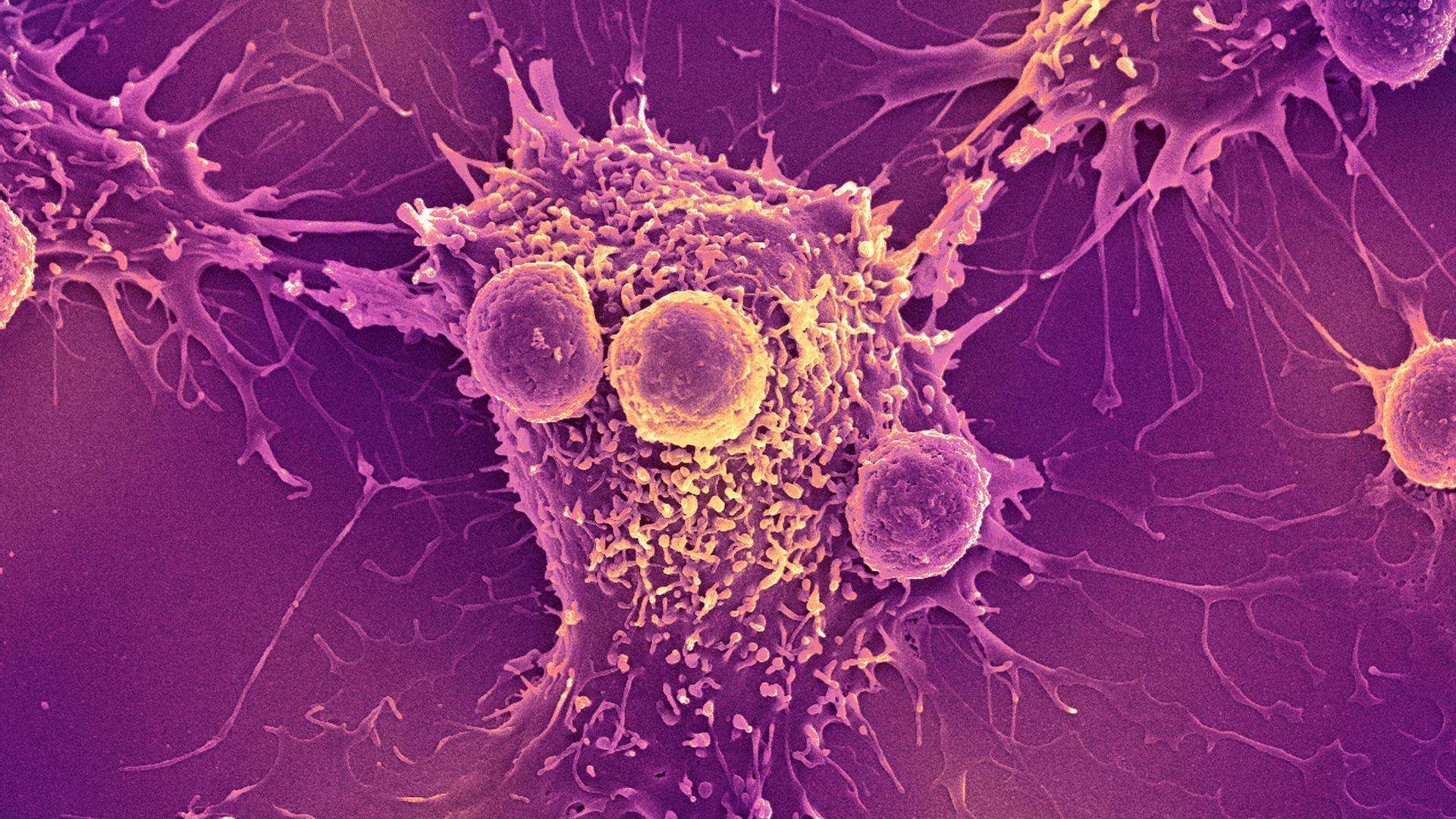 image for COVID-19 mRNA vaccines can trigger the immune system to recognize and kill cancer, research finds
