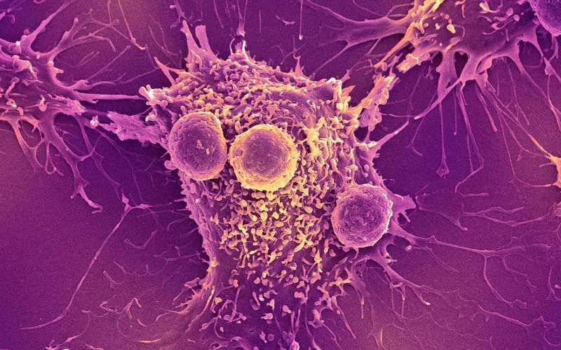 image for COVID-19 mRNA vaccines can trigger the immune system to recognize and kill cancer, research finds