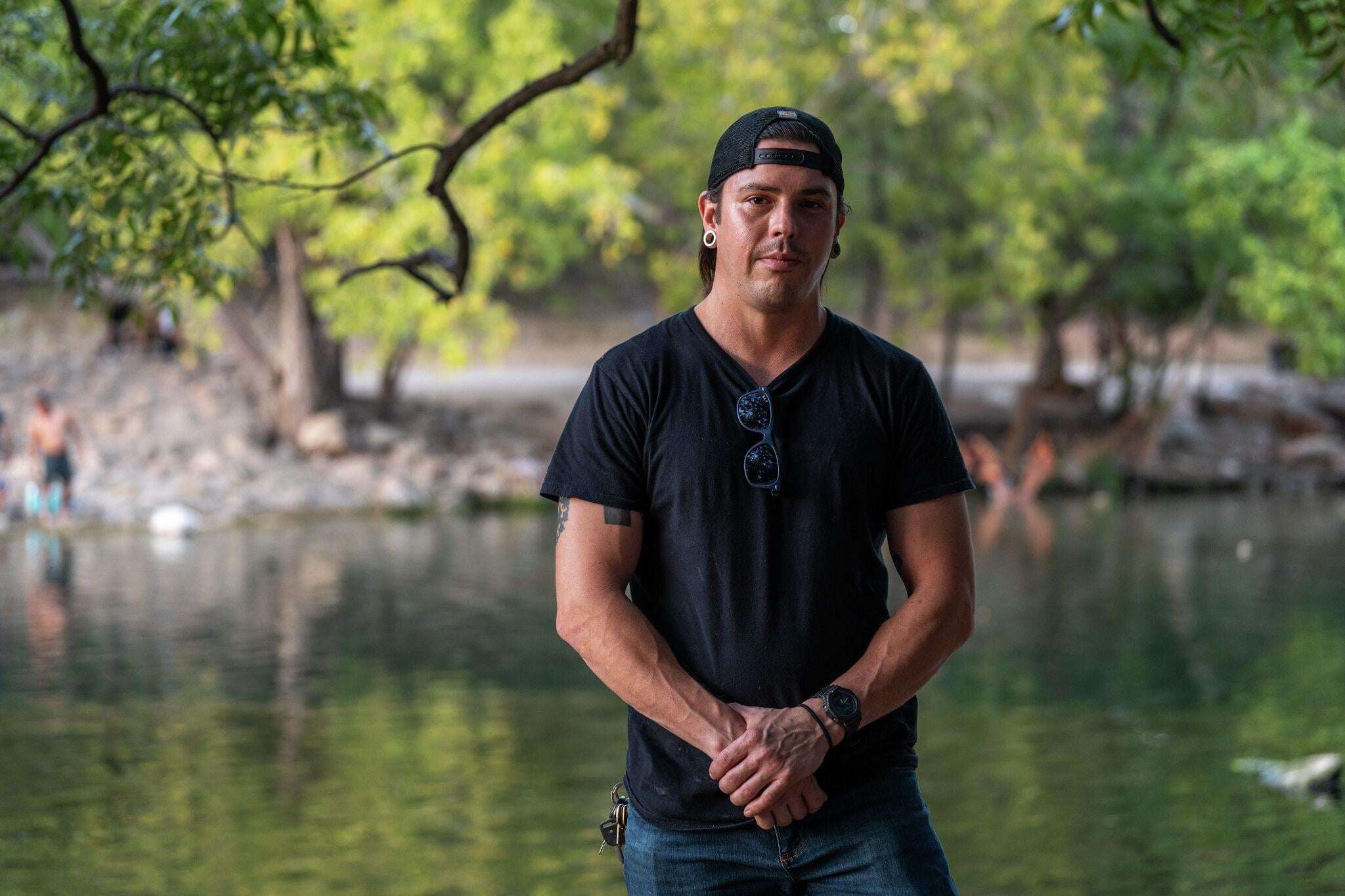 image for Austin man gets free jaw surgery after protecting trans woman