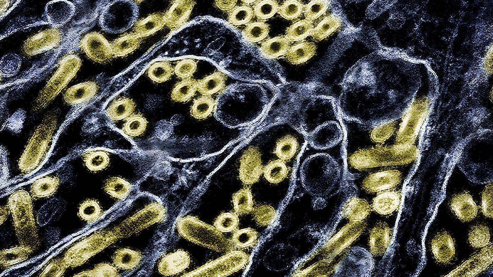 image for 1st human known to be infected with H5N5 strain of bird flu dies, Washington state officials say