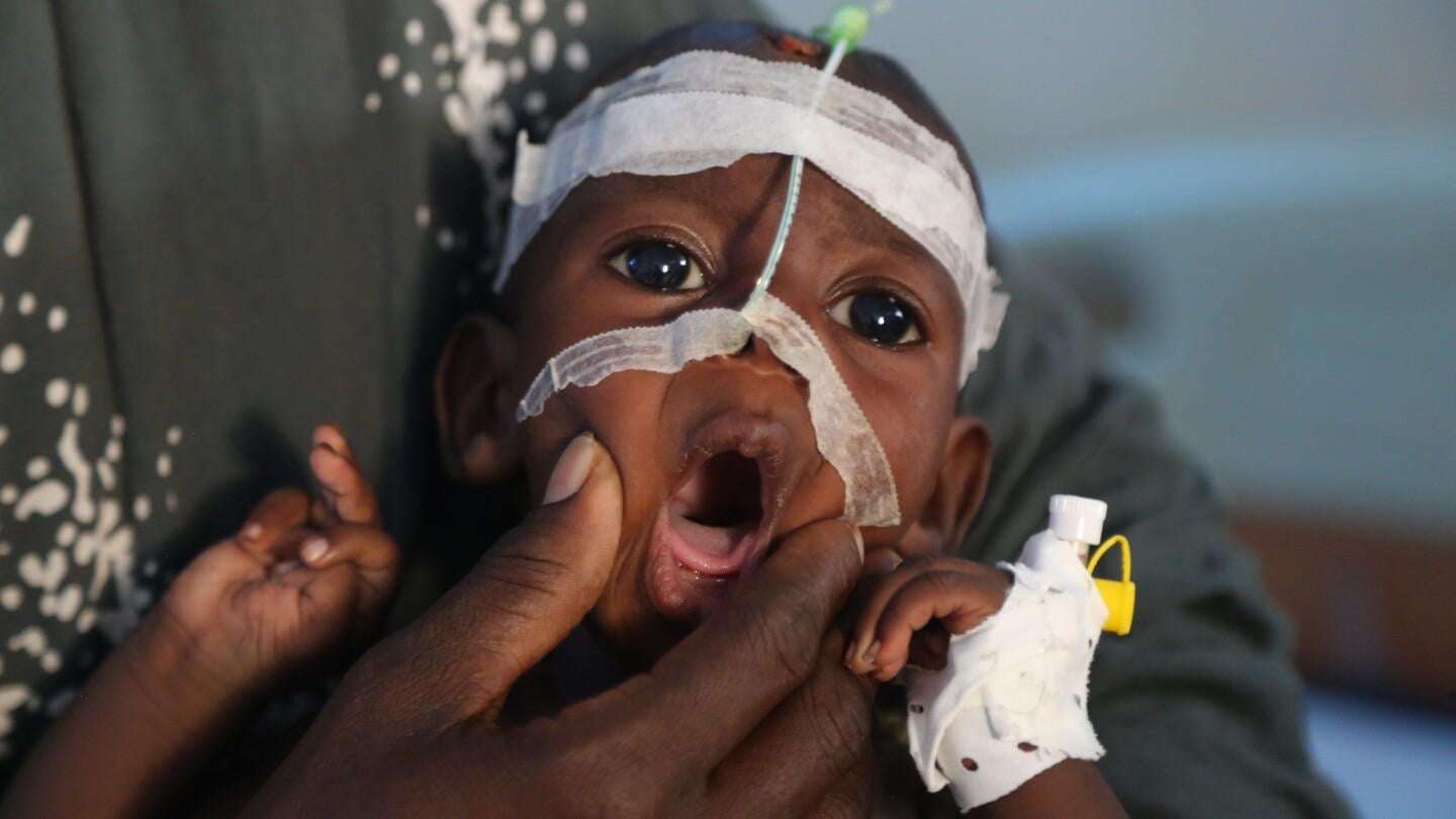image for The world turns a blind eye as war-torn Somalia’s hospitals crumble
