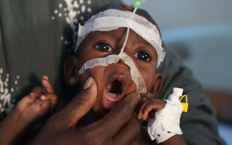 image for The world turns a blind eye as war-torn Somalia’s hospitals crumble