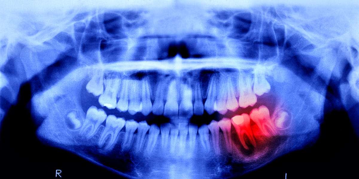 image for Humans May Be Able to Grow New Teeth Within Just 4 Years