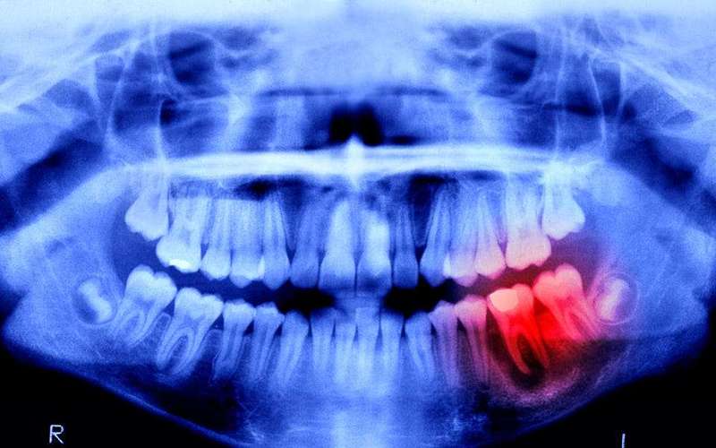 image for Humans May Be Able to Grow New Teeth Within Just 4 Years