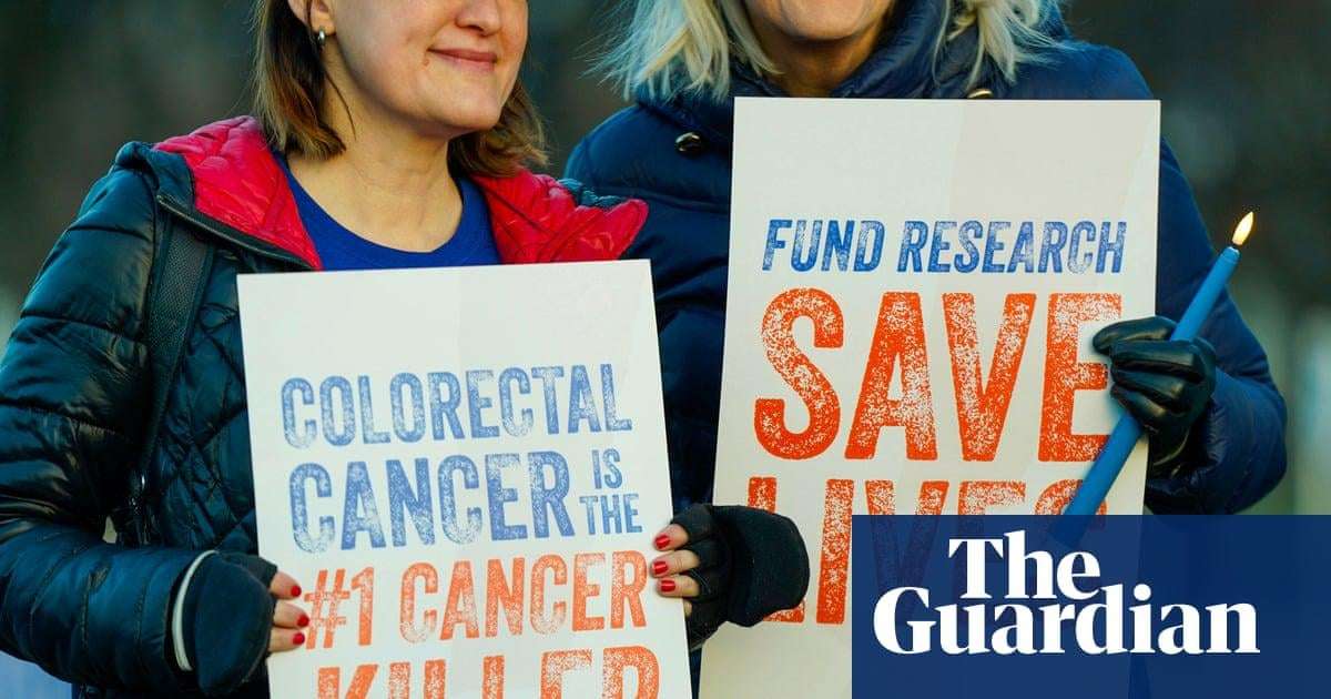 image for Colon cancer now leading cause of cancer deaths under 50 in US