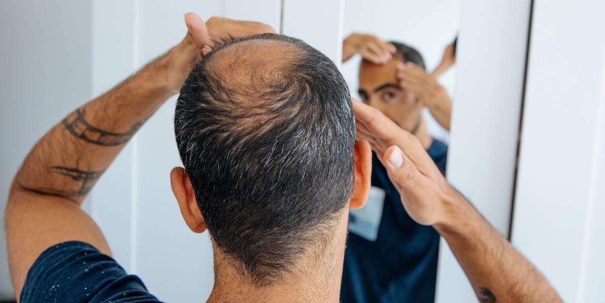 image for Scientists Built Working Hair Follicles in a Lab. They Could Cure Baldness Forever.