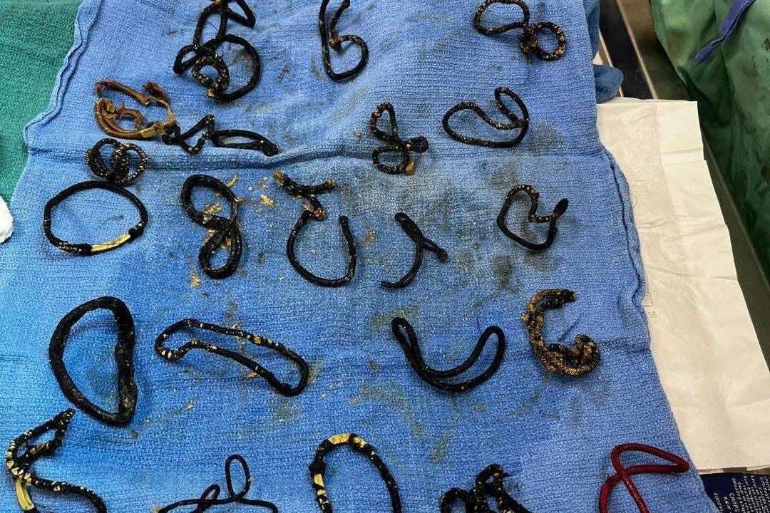 image for Look: Florida cat gets surgery after swallowing 26 hair ties