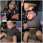 image for Pics of Karim Abu Nasser, a Gaza toddler after being tortured by the IDF
