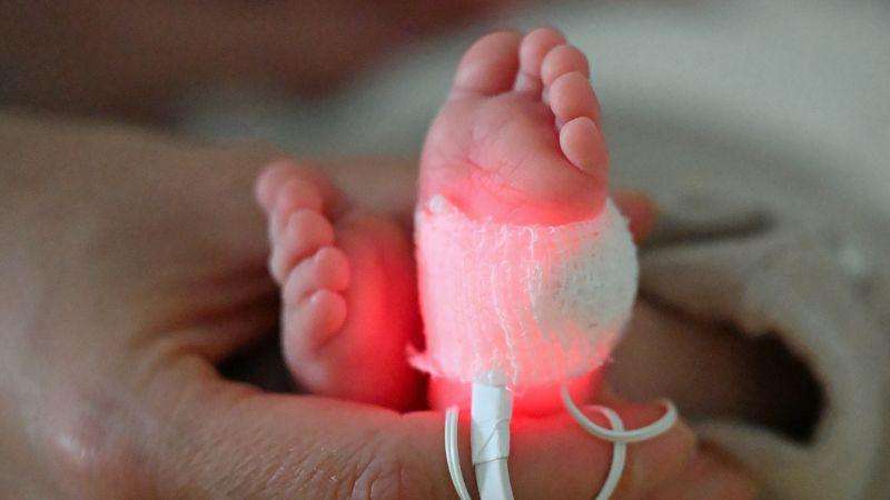 image for A common plastic toxin may be linked to infant deaths and prematurity, study says