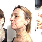 image for After a woman had her entire body tattoos by a toxic ex, she managed to have them removed