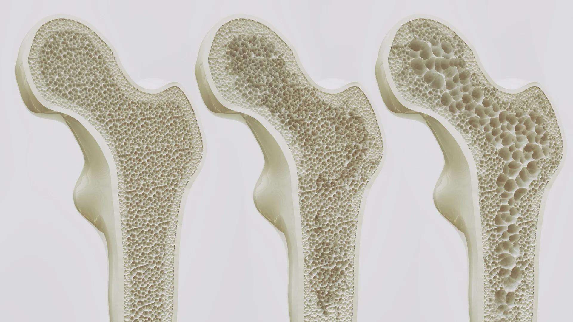 image for Scientists may have found a way to keep your bones strong for life