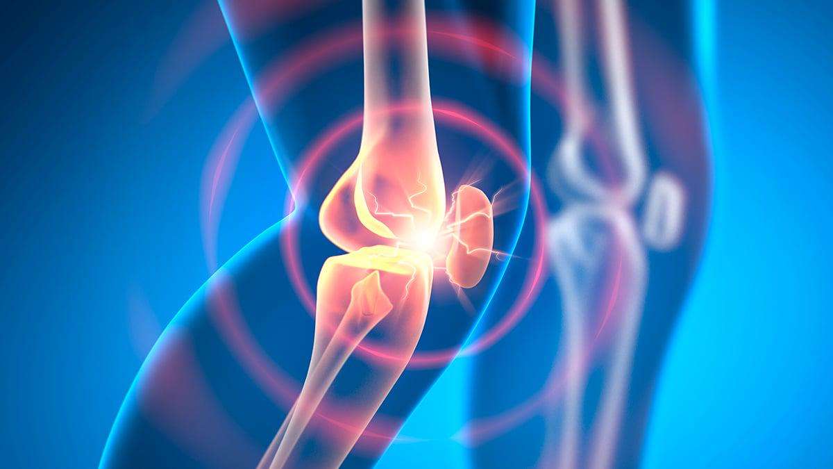 image for Experimental Drug Can Reverse Osteoarthritis in Weeks, Animal Research Shows