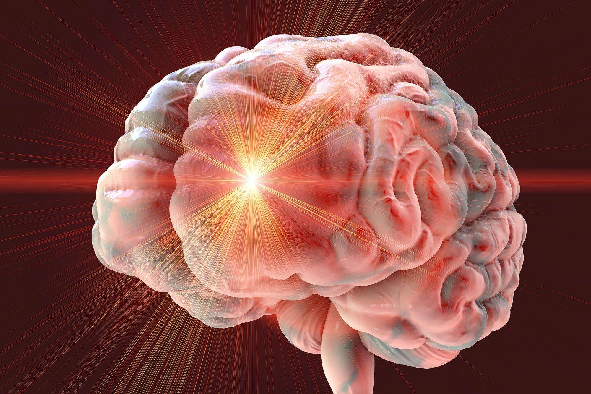 image for Scientists Reverse Stroke Damage Using Stem Cells in Breakthrough Study