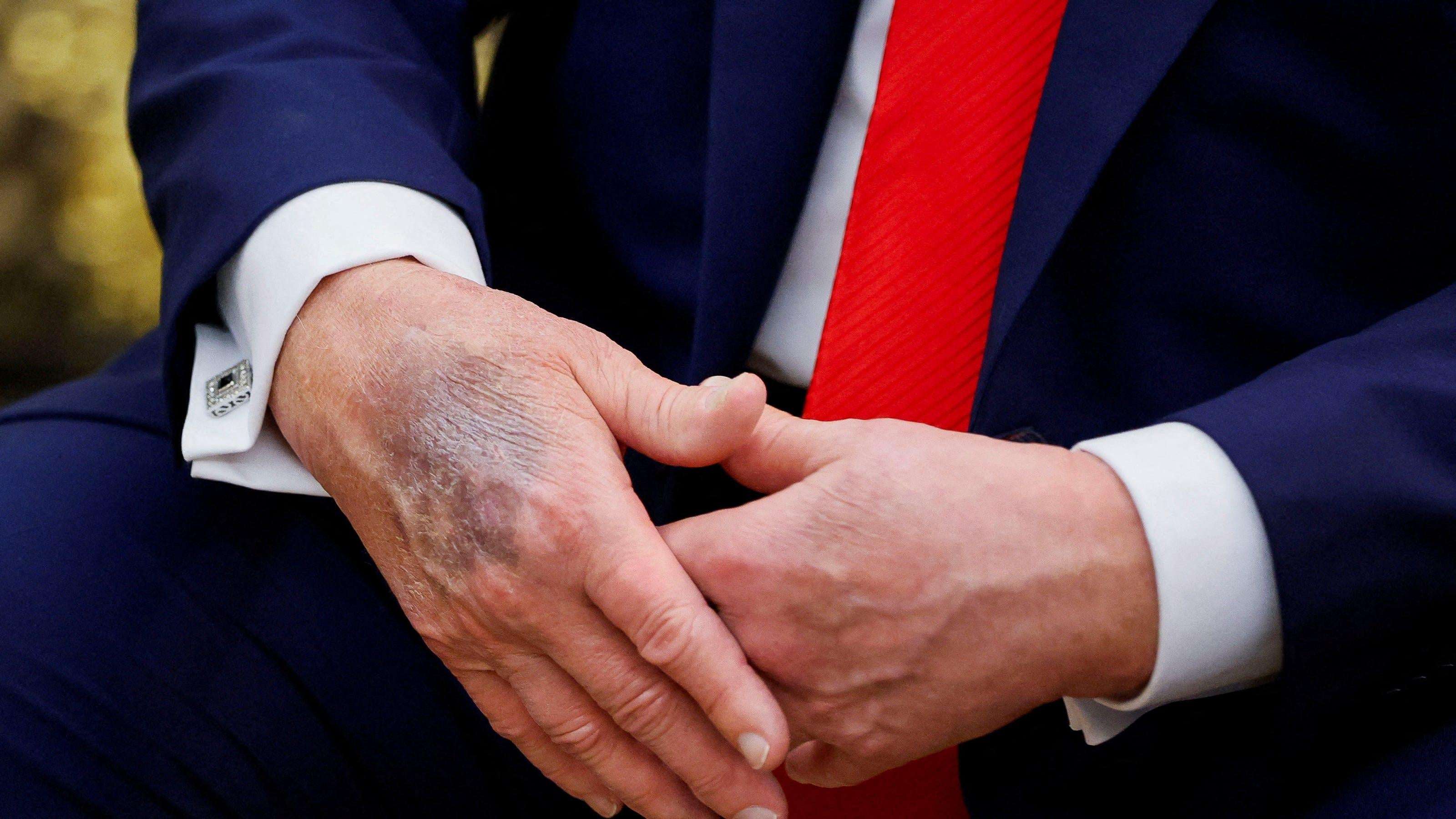 image for White House releases Trump's physical results, says he's in 'excellent health' but almost obese