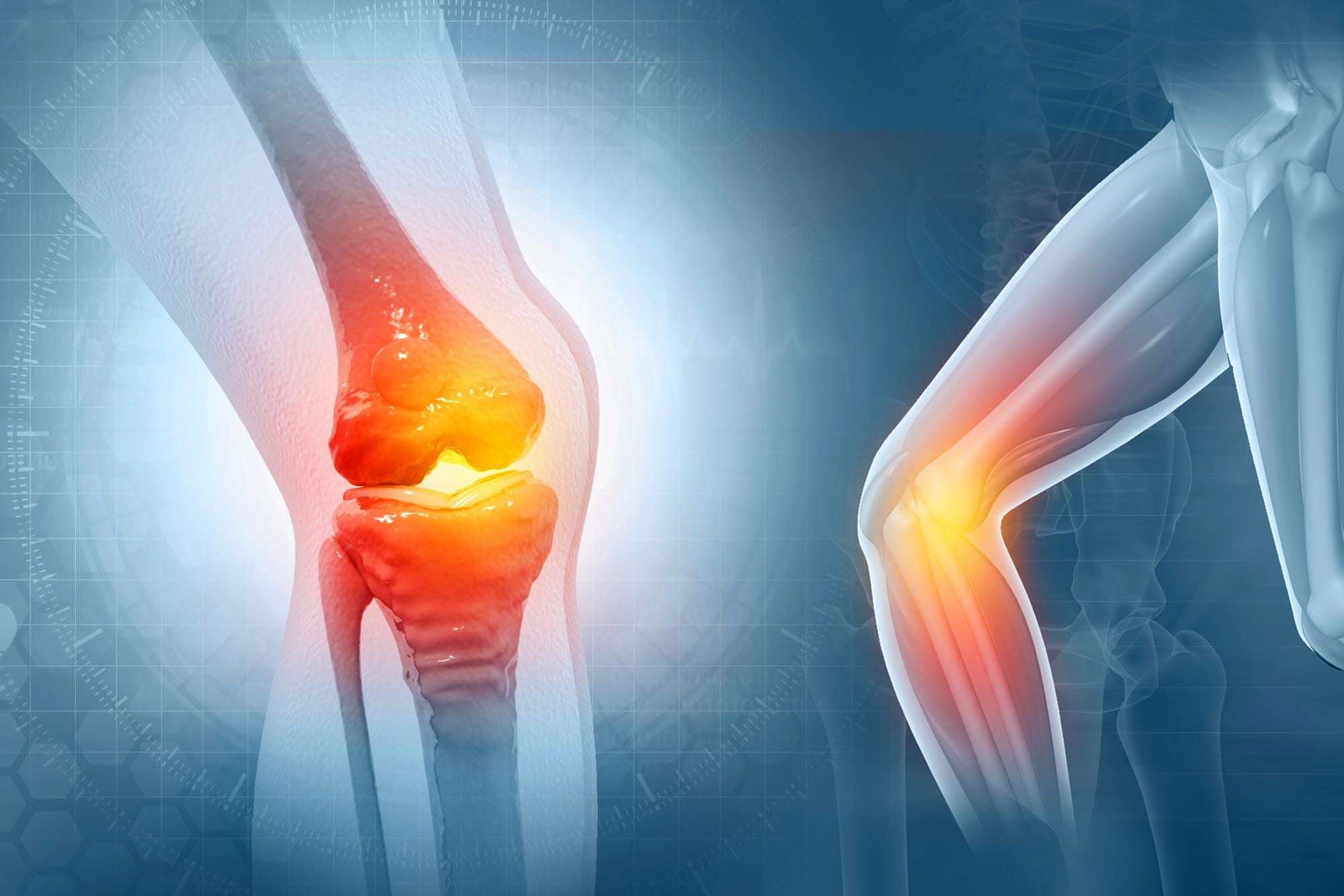 image for New Treatment Could Reverse Osteoarthritis Within Weeks