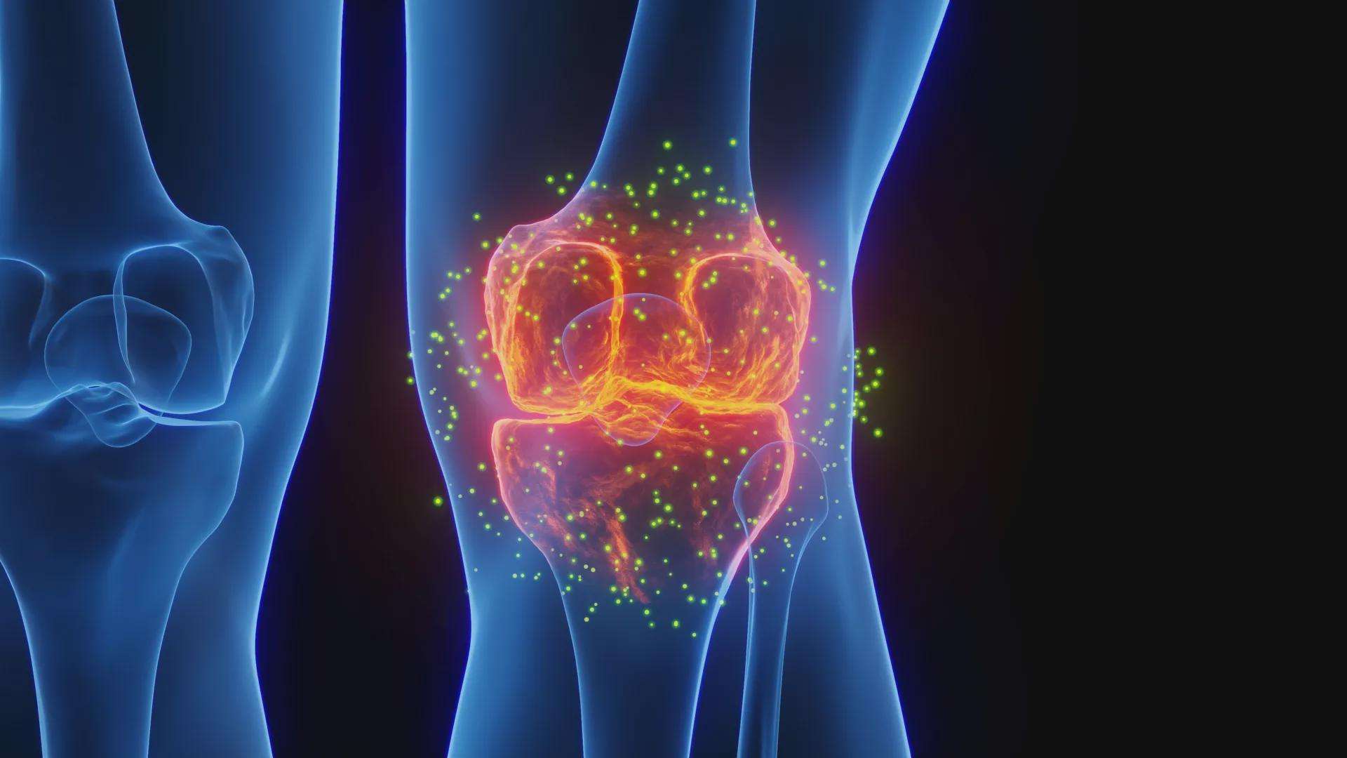 image for Stanford scientists regrow lost cartilage and reverse arthritis in major breakthrough