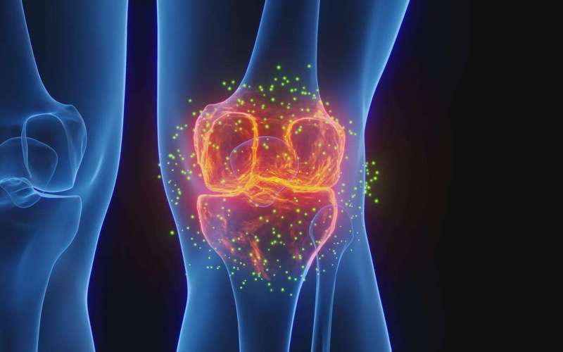 image for Stanford scientists regrow lost cartilage and reverse arthritis in major breakthrough