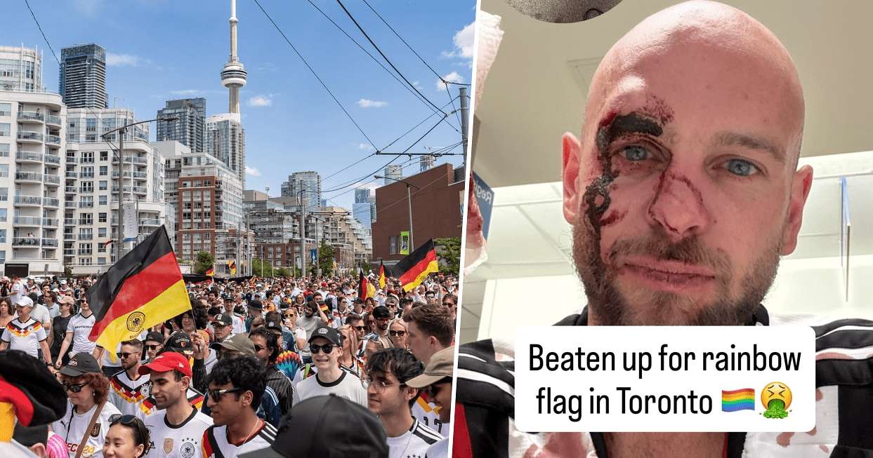 image for German FIFA World Cup Fan Attacked and Injured for Waving a Rainbow-Colored Fan