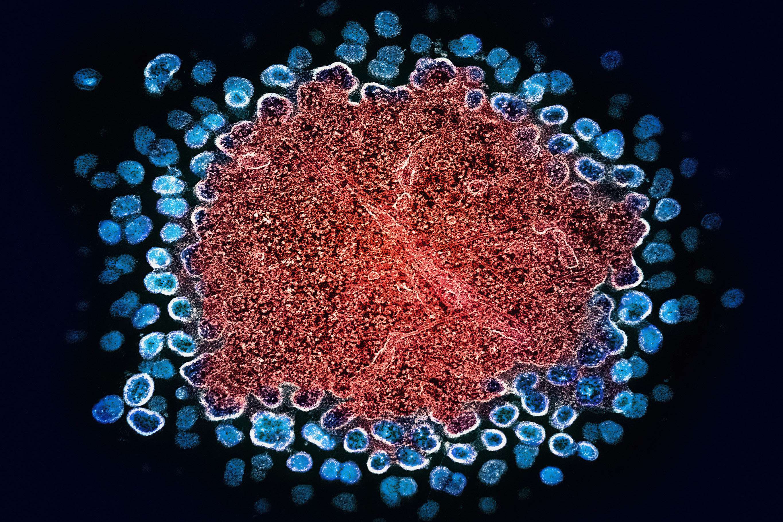 image for New HIV treatment could enable people to safely stop daily medication