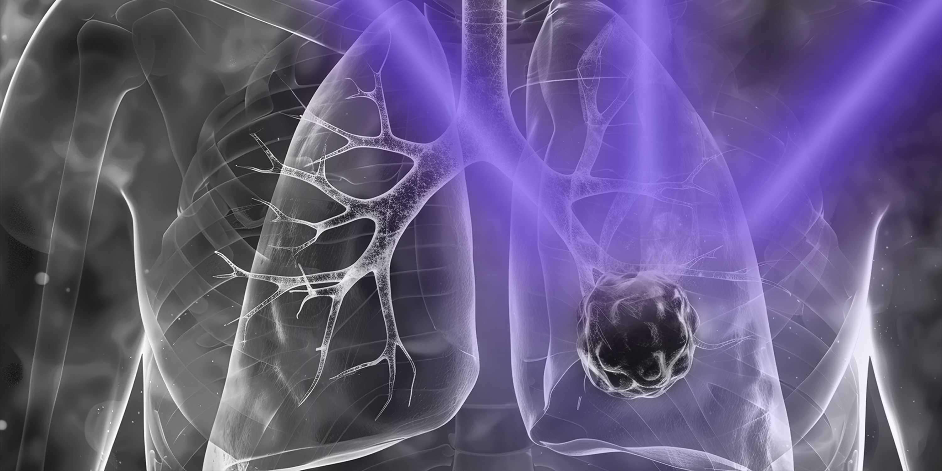 image for Light switch makes cancer vulnerable to attack