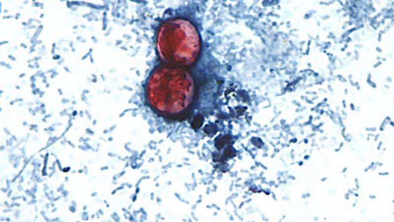 image for Diarrhea-causing parasite that can contaminate raw produce causing misery across several states