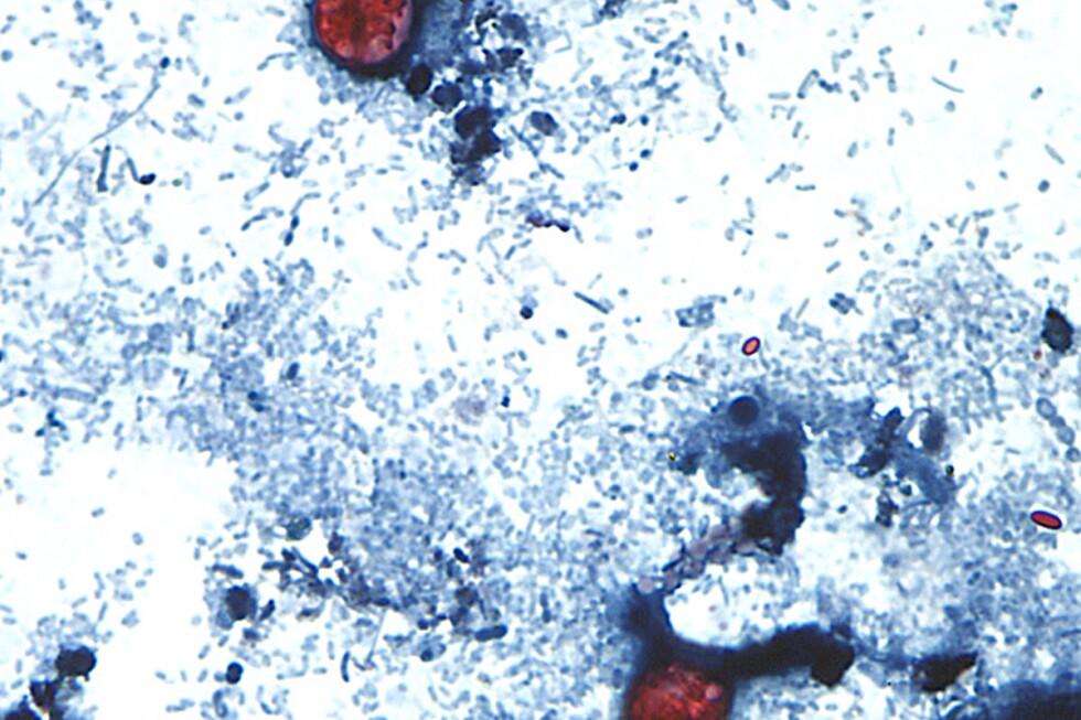 image for Outbreak of diarrhea-causing parasite grows to more than 1,000 cases