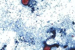 image for 