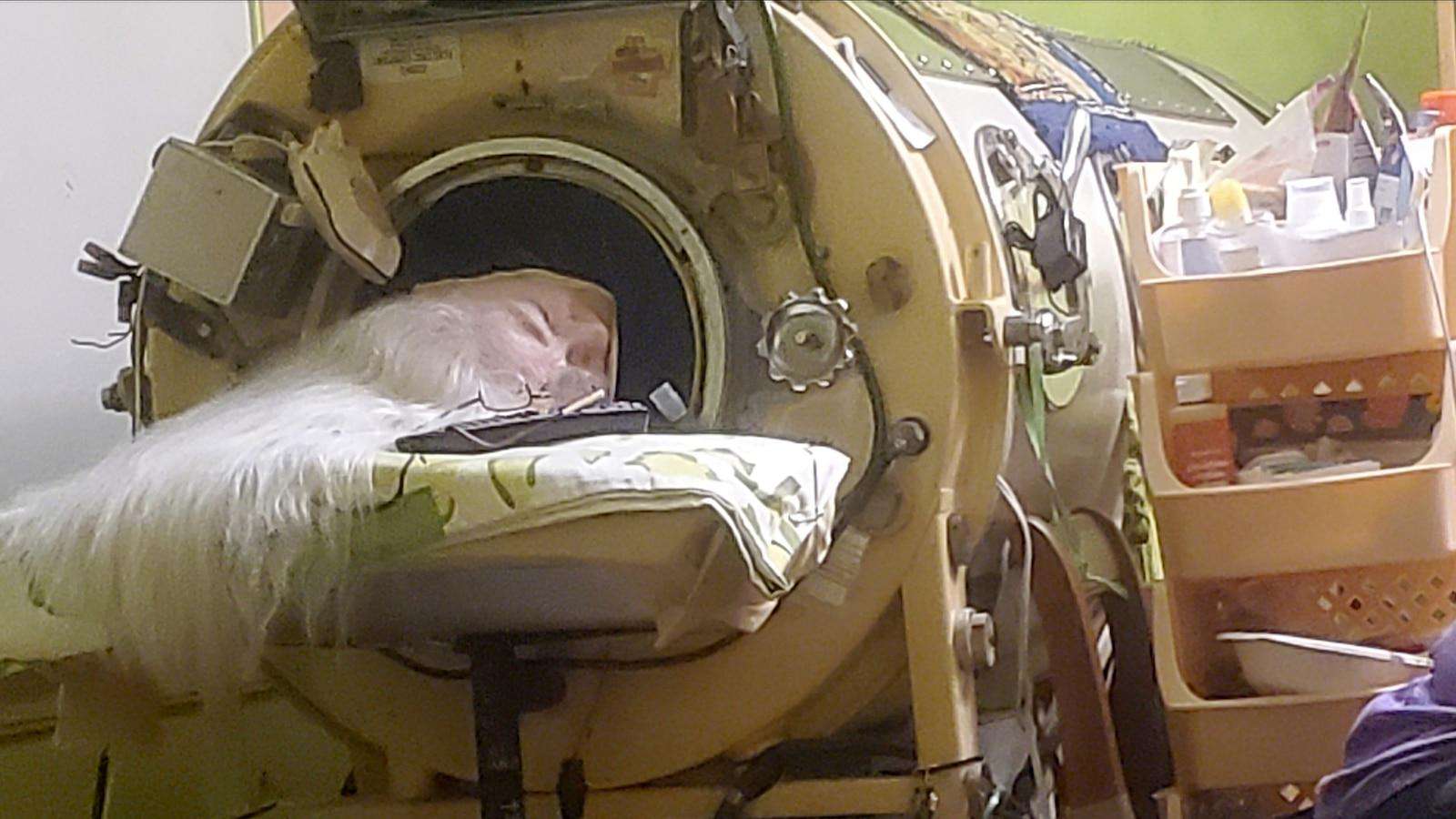 image for Martha Lillard, last US polio patient using iron lung, dies at 78 in Oklahoma