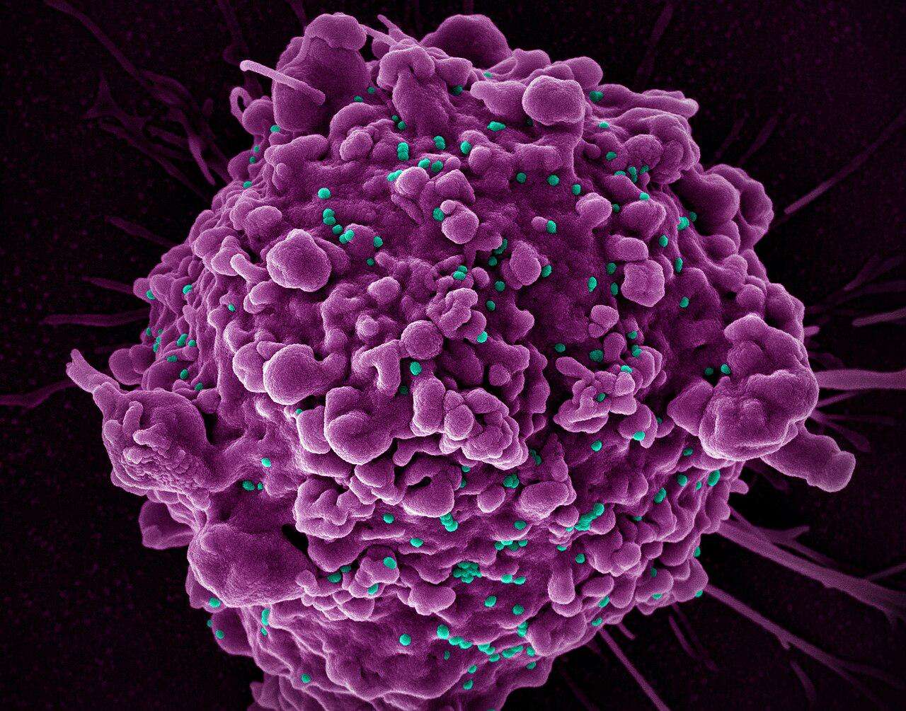 image for New HIV vaccine shows unprecedented success in preclinical study – lji.org