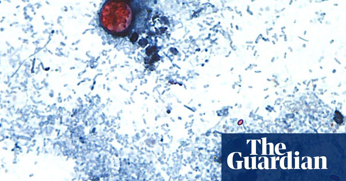 image for Michigan health officials identify ‘potential source’ of parasite outbreak