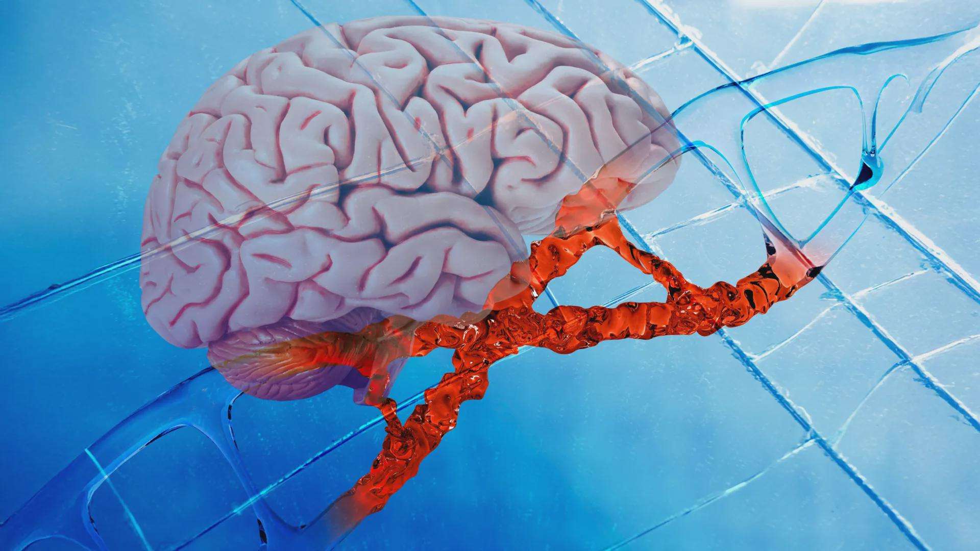 image for New Alzheimer's drug repairs DNA damage and reduces brain inflammation