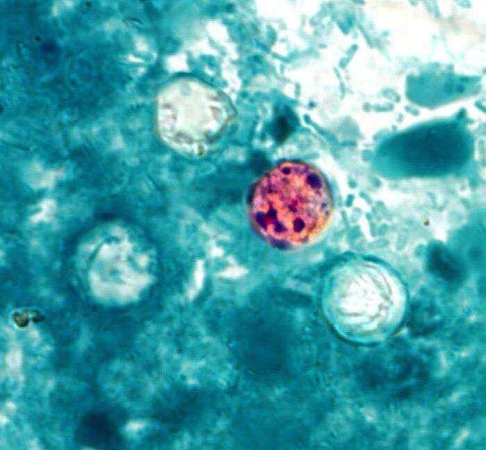 image for FDA reports new outbreak of explosive diarrhea with 72 cases identified